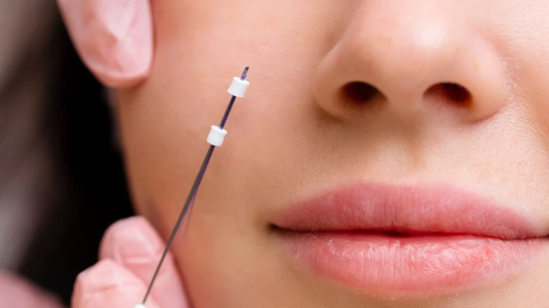 PDO thread treatment